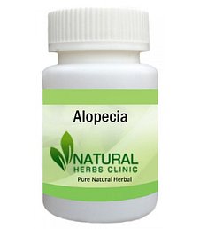 Herbal Product for Alopecia