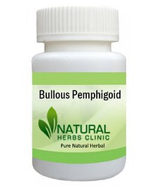 Herbal Product for Bullous Pemphigoid
