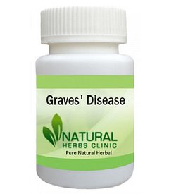 Herbal Product for Graves Disease