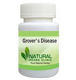 Herbal Product for Grovers Disease