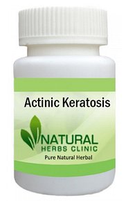 Herbal Product for Actinic Keratosis